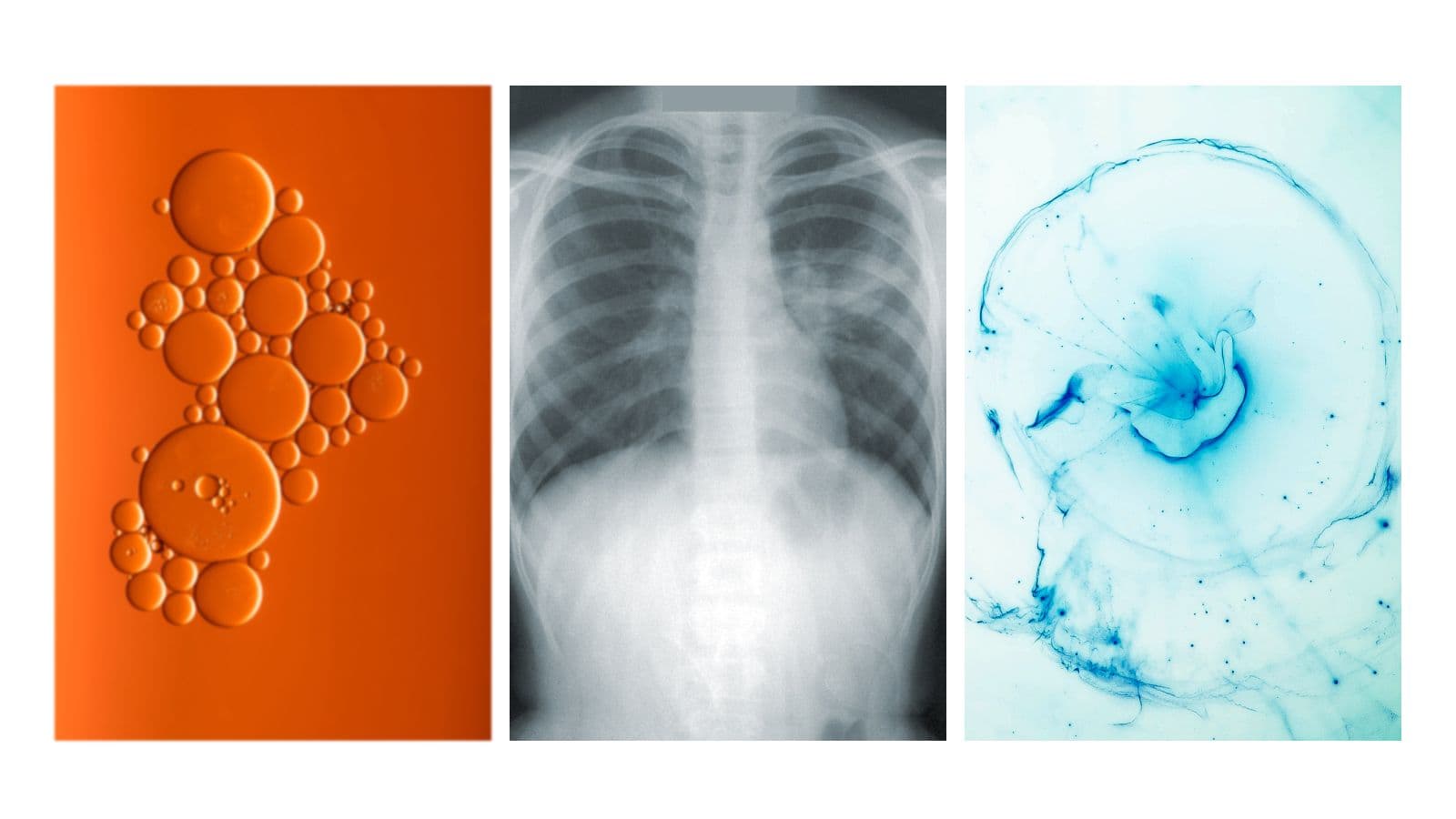 Japan will be the leader of next-generation therapeutics in cancer treatment with these startups