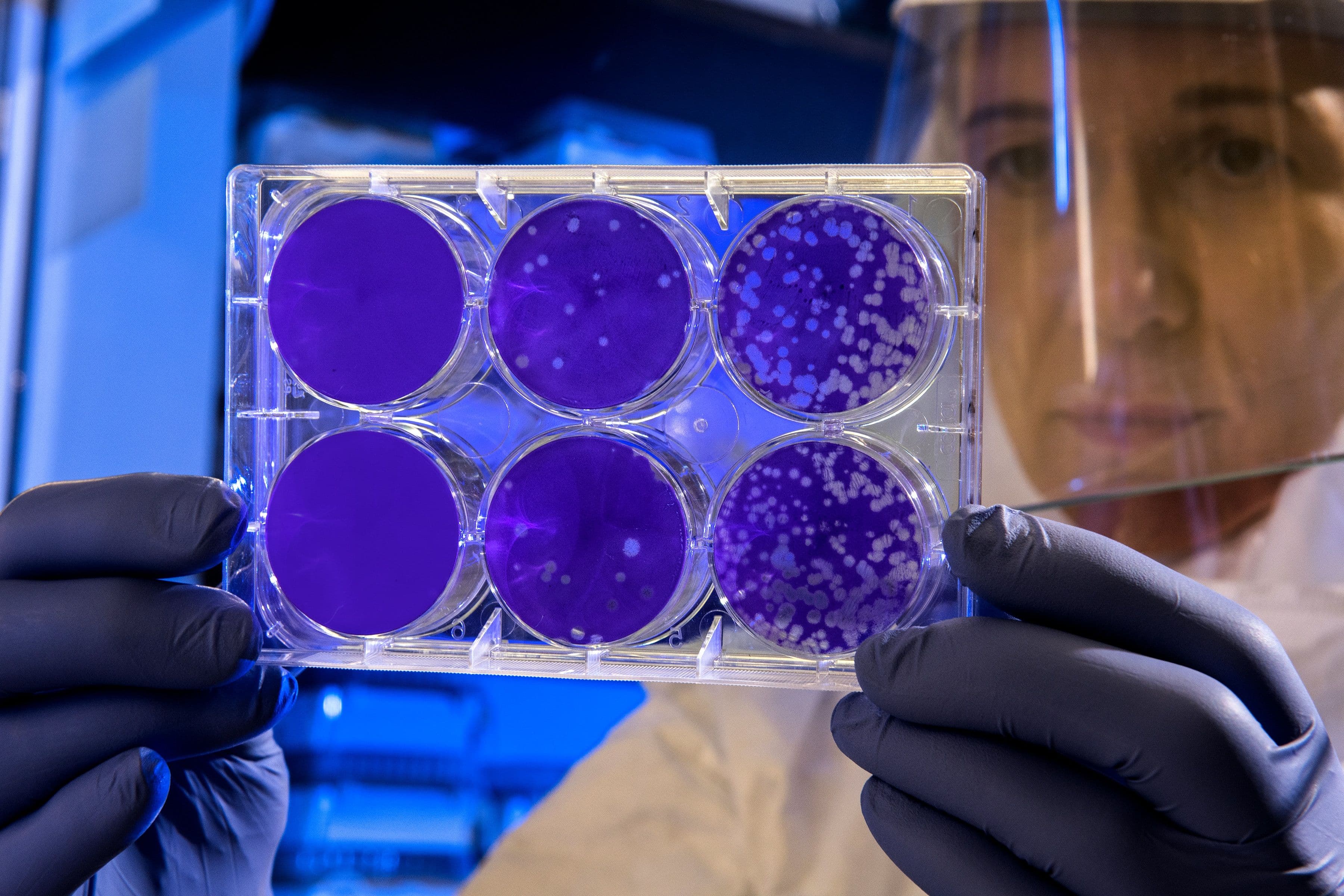 Metagen Therapeutics completes Series A financing totaling 1.7 billion yen